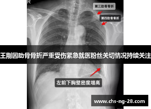 王刚因肋骨骨折严重受伤紧急就医粉丝关切情况持续关注